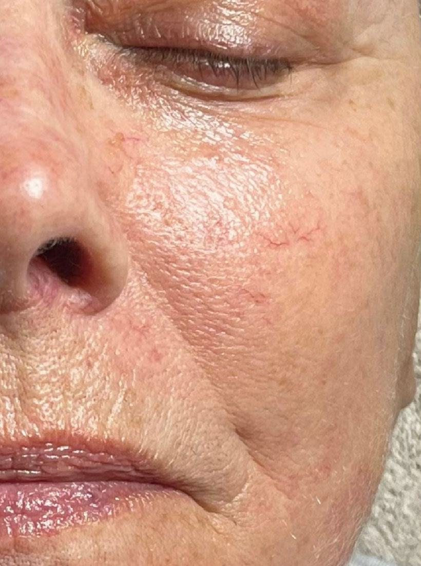 ghk-cu peptide risks side effects Rejuvenation and Youth with GHK-Cu Peptide Treatment main image 1