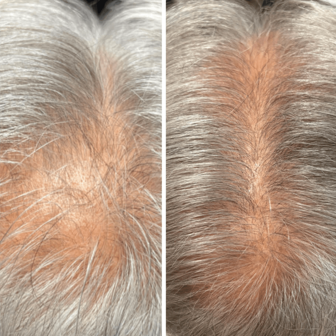 ghk-cu copper peptide topical hair growth study Absolute GROW: GHK-cu Copper Peptide Hair Growth Tajikistan main image 1