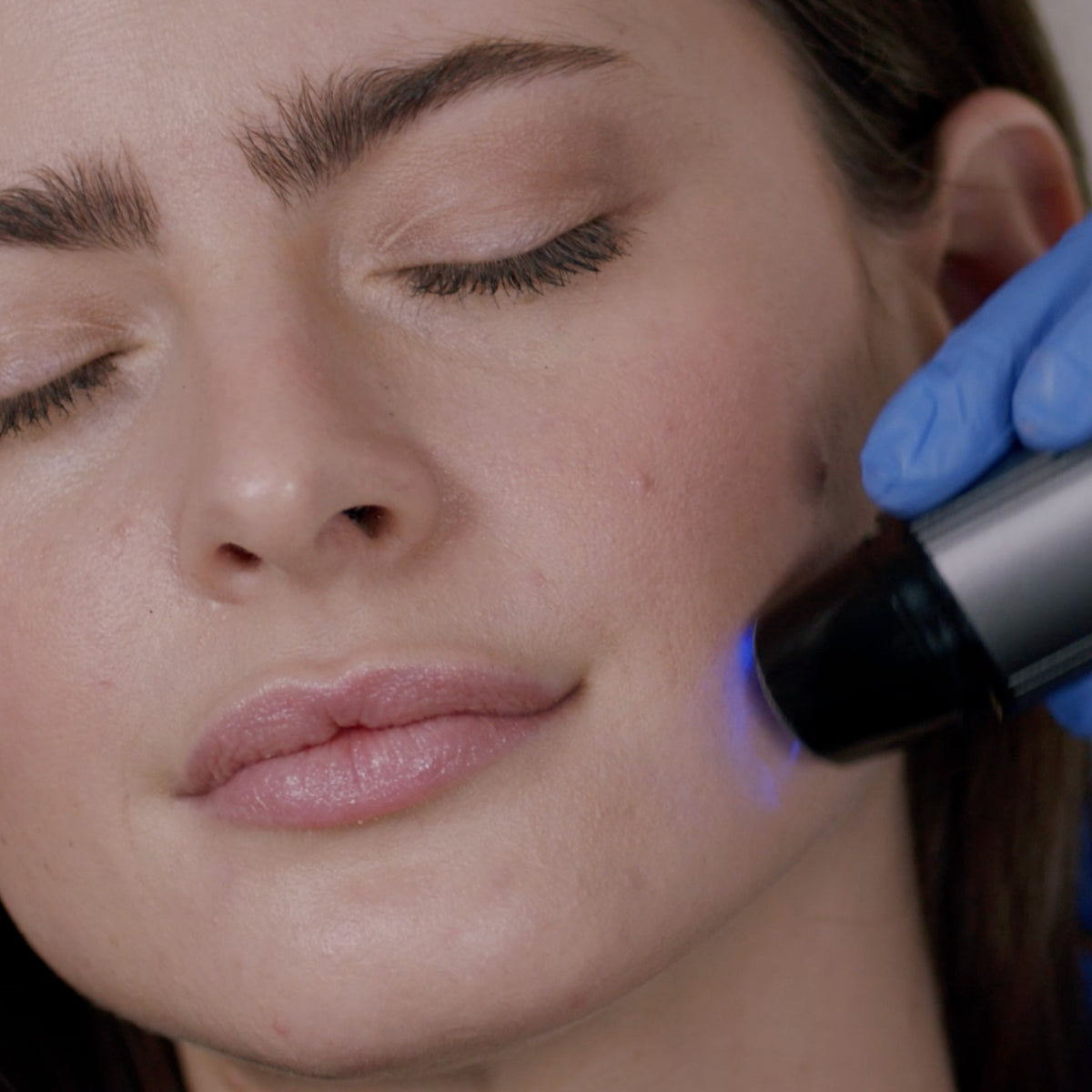 Juvasonic device held in a gloved hand against a woman's cheek, blue light on