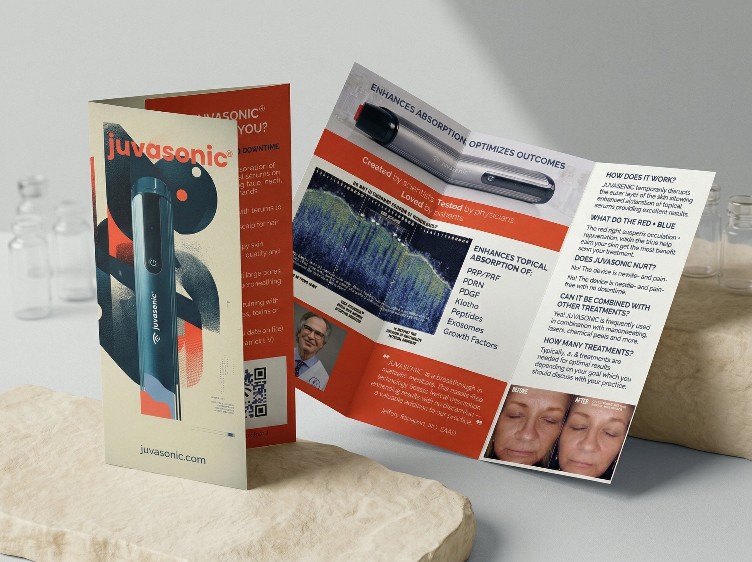 Juvasonic® Patient Brochure (25 pack)